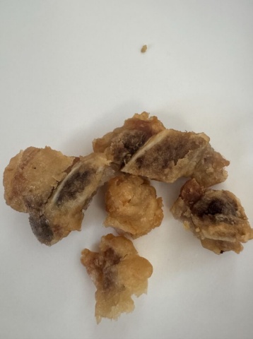 ポークチョップは骨に注意（衣がついている）